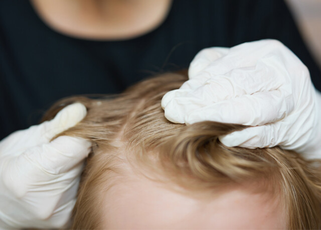 15/12 - ANALISI TRICOLOGICA GRATUITA CON SCONTI